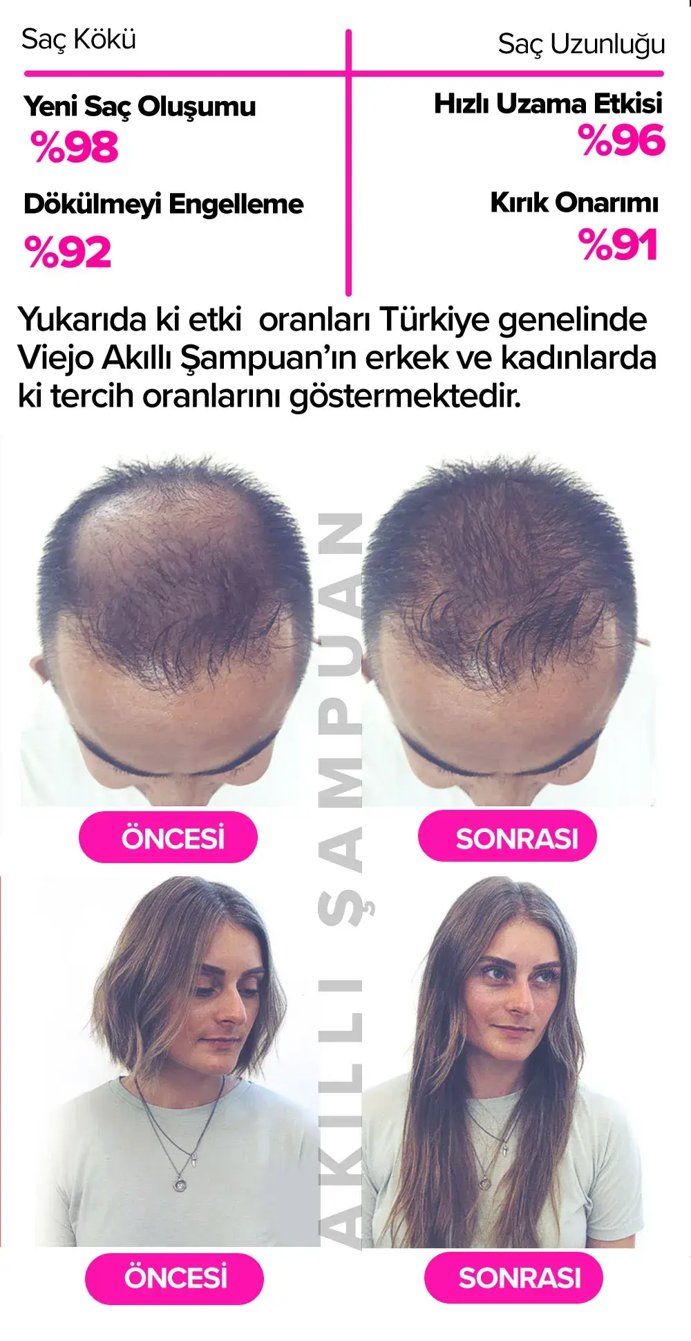 Viejo Şampuan